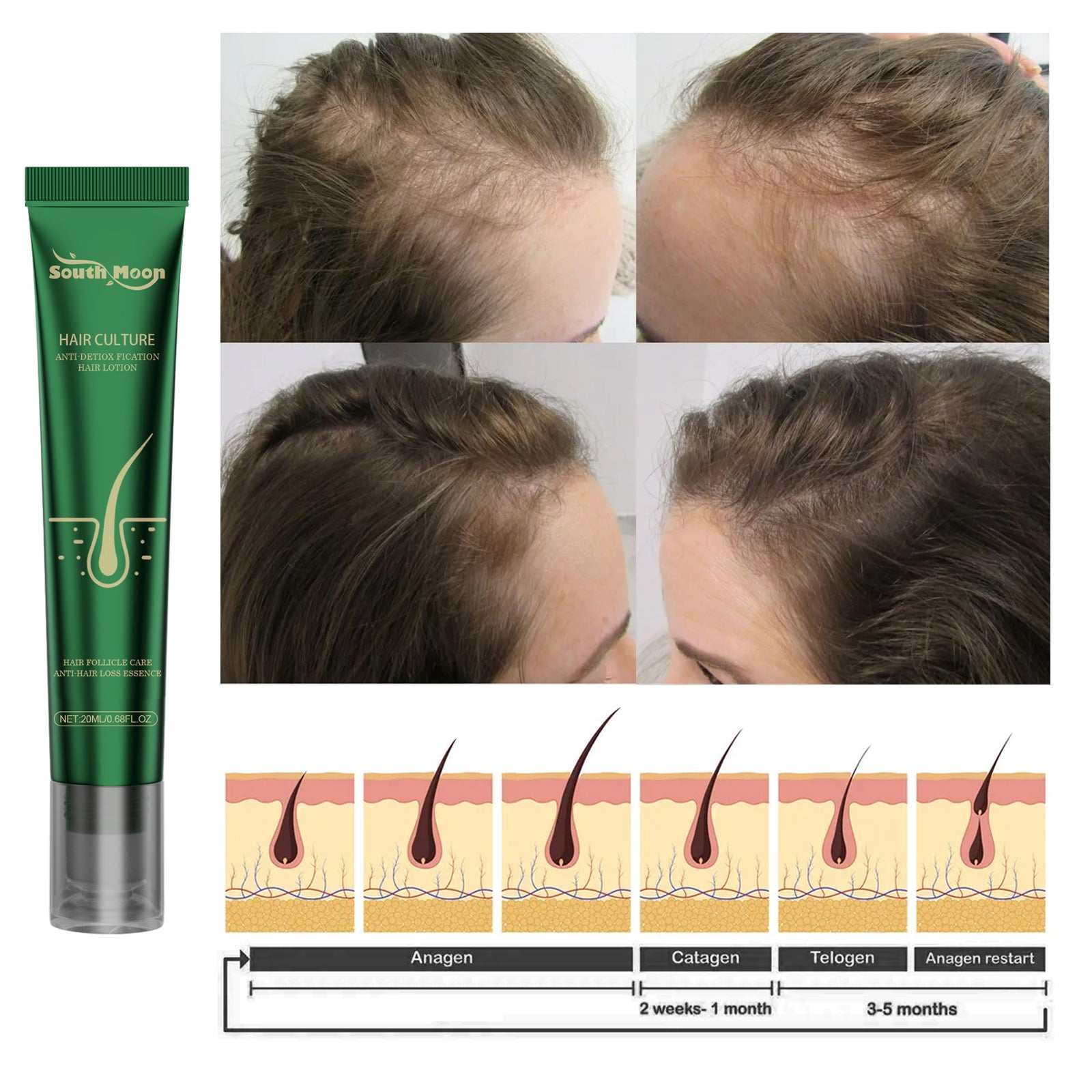 Ginger Scalp Essence for Dry Hair - Nourish & Strengthen Roots